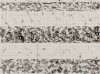 Image of Tres franjas de puntos